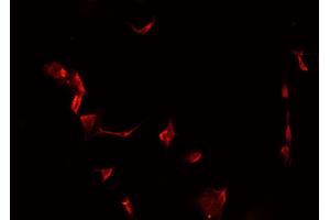 ABIN6266983 staining MCF-7 cells by IF/ICC. (MAST4 anticorps  (N-Term))
