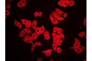 FHC cells probed with Rabbit Anti-RAC1(Ser71) Polyclonal Antibody Alexa Fluor Cy3