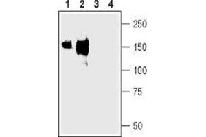 Western blot analysis of rat (lanes 1 and 3) and mouse (lanes 2 and 4) kidney membranes: - 1,2.