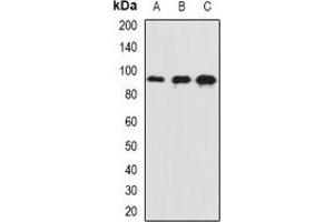 Western blot analysis of AP180 expression in mouse brain (A), mouse eye (B), rat brain (C) whole cell lysates. (SNAP91 anticorps)