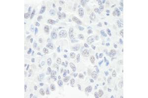 Immunohistochemistry (IHC) image for anti-SWI/SNF Related, Matrix Associated, Actin Dependent Regulator of Chromatin, Subfamily E, Member 1 (SMARCE1) (C-Term) antibody (ABIN7448428)