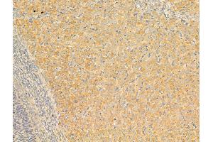 ABIN6255370 and ABIN6267631 at 1/100 staining Rat ovary tissue by IHC-P. (PRKAA1 anticorps  (pSer486))