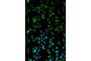 Immunofluorescence analysis of HeLa cells using TPM3 antibody.