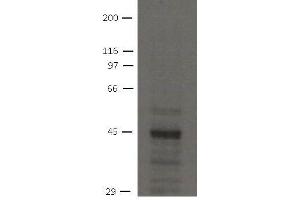 Image no. 1 for anti-Solute Carrier Family 9 (Sodium/hydrogen Exchanger), Member 3 Regulator 2 (SLC9A3R2) antibody (ABIN1169696) (SLC9A3R2 anticorps)