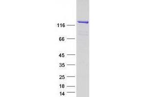 Validation with Western Blot