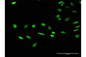 Immunofluorescence of purified MaxPab antibody to GTF2E1 on HeLa cell. (GTF2E1 anticorps  (AA 1-439))