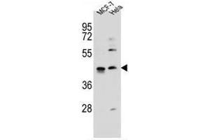 ZNF384 Antibody (C-term) western blot analysis in MCF-7, Hela cell line lysates (35 µg/lane).