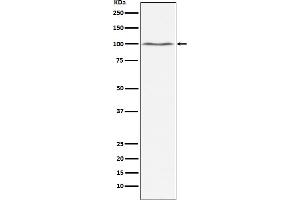 Western blot analysis of Dynamin 2 expression in Jurkat cell lysate.