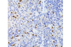 Immunohistochemistry of paraffin-embedded Mouse spleen using SMAD2 Polyclonal Antibody at dilution of 1:100 (40x lens). (SMAD2 anticorps)