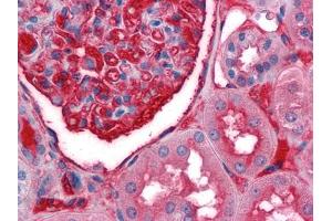 Immunohistochemical analysis of paraffin-embedded human Kidney tissues using anti-A1BG mouse mAb (A1BG anticorps)