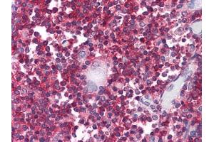 Immunohistochemical analysis of paraffin-embedded human Thymus tissues using anti-CD247 antibody (CD247 anticorps)