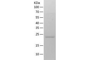 Western Blotting (WB) image for Carboxymethylenebutenolidase Homolog (CMBL) (AA 1-245) protein (His-IF2DI Tag) (ABIN7122139)