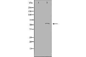 Western blot analysis of extracts from Jurkat cells using ACOT2 antibody.