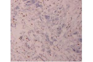 IHC-P analysis of Human Pancreas Tissue, with DAB staining. (FLG2 anticorps  (AA 1222-1368))