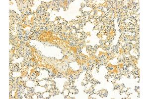 ABIN6262590 and ABIN6266579 at 1/100 staining Rat lung tissue by IHC-P.