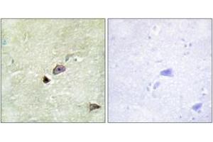 Immunohistochemistry analysis of paraffin-embedded human brain tissue, using TRIM59 Antibody. (TRIM59 anticorps  (AA 191-240))