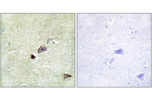 Immunohistochemistry analysis of paraffin-embedded human brain tissue, using TRIM59 Antibody. (TRIM59 anticorps  (AA 191-240))