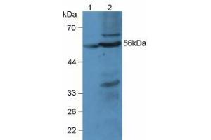 Western blot analysis of (1) Rat Liver Tissue and (2) Mouse Liver Tissue. (LPCAT3 anticorps  (AA 122-233))
