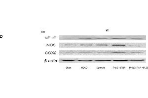 Expression of NF-κB, iNOS and COX-2 in response to Prdx6 siRNA and MJ33. (NOS2 anticorps)