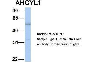 Host: Rabbit Target Name: AHCYL1 Sample Type: Human Fetal Liver Antibody Dilution: 1. (AHCYL1 anticorps  (N-Term))