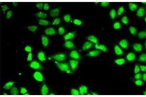Immunofluorescence analysis of MCF-7 cells using PSMC3 Polyclonal Antibody (PSMC3 anticorps)