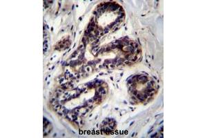PCCA Antibody (Center) immunohistochemistry analysis in formalin fixed and paraffin embedded human breast tissue followed by peroxidase conjugation of the secondary antibody and DAB staining. (PCCA anticorps  (Middle Region))