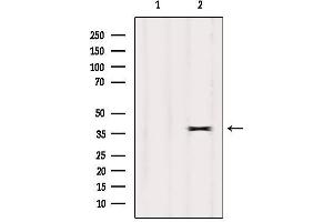 Western blot analysis of extracts from Mouse brain, using OR7E24 Antibody. (OR7E24 anticorps)