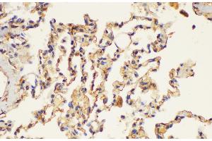Immunohistochemistry of paraffin-embedded Human lung using PLAUR Ployclonal Antibody at dilution of 1:200. (PLAUR anticorps)