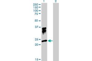 Western Blot analysis of ORM1 expression in transfected 293T cell line by ORM1 MaxPab polyclonal antibody. (ORM1 anticorps  (AA 1-201))
