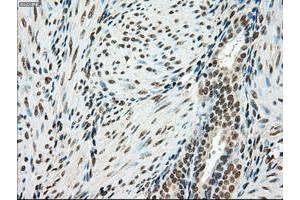 Image no. 8 for anti-Sjogren Syndrome Antigen B (SSB) antibody (ABIN1501146)