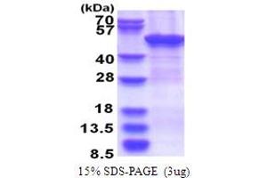 SDS-PAGE (SDS) image for Zinc Finger, CCHC Domain Containing 12 (ZCCHC12) (AA 1-402) protein (His tag) (ABIN5853735)