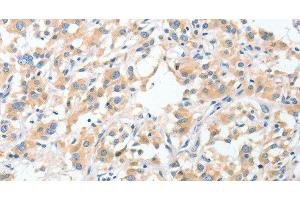 anti-Ribophorin 1 (RPN1) antibody