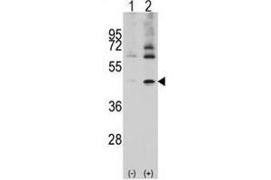 Image no. 2 for anti-Actin, Alpha, Cardiac Muscle 1 (ACTC1) (Center) antibody (ABIN357023) (ACTC1 anticorps  (Center))