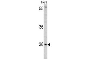 Western blot analysis of HPRT1 antibody (C-term) in Hela cell line lysates (35ug/lane). (HPRT1 anticorps  (C-Term))