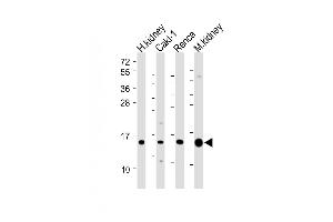 All lanes : Anti-ATP6V1G3 Antibody (N-Term) at 1:2000 dilution Lane 1: Human kidney lysate Lane 2: Caki-1 whole cell lysate Lane 3: Renca whole cell lysate Lane 4: Mouse kidney lysate Lysates/proteins at 20 μg per lane. (ATP6V1G3i anticorps  (AA 15-49))