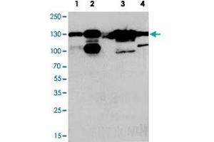 Western blot analysis of whole cell extracts with THBS2 polyclonal antibody . (Thrombospondin 2 anticorps  (Middle Region))