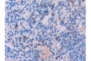 Detection of UCN3 in Mouse Spleen Tissue using Polyclonal Antibody to Urocortin 3 (UCN3)