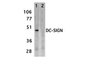 Western Blotting (WB) image for anti-CD209 (CD209) (Extracellular Domain) antibody (ABIN1030833) (DC-SIGN/CD209 anticorps  (Extracellular Domain))