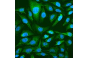 IF analysis of OAS3 using anti-OAS3 antibody (ABIN7602725). (OAS3 anticorps  (AA 990-1087))