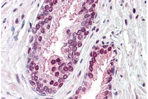 Anti-CDCP1 antibody  ABIN960755 IHC staining of human prostate. (CDCP1 anticorps  (Internal Region))