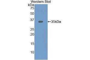 Detection of Recombinant LOX1, Rat using Polyclonal Antibody to Lectin Like Oxidized Low Density Lipoprotein Receptor 1 (LOX1) (OLR1 anticorps  (AA 51-314))