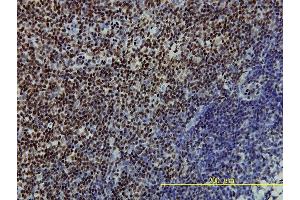 Immunoperoxidase of monoclonal antibody to SSB on formalin-fixed paraffin-embedded human tonsil tissue.