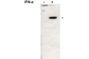 Image no. 1 for anti-Signal Transducer and Activator of Transcription 2, 113kDa (STAT2) (pTyr690) antibody (ABIN291118) (STAT2 anticorps  (pTyr690))