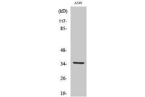 Western Blotting (WB) image for anti-Carbonic Anhydrase VA (CA5A) (Internal Region) antibody (ABIN3183596) (CA5A anticorps  (Internal Region))