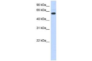 CDYL antibody used at 1 ug/ml to detect target protein.