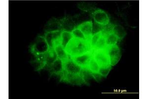 Immunofluorescence of monoclonal antibody to DNAI2 on A-431 cell. (DNAI2 anticorps  (AA 1-593))