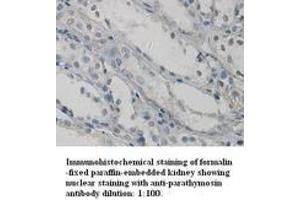 Image no. 1 for anti-Parathymosin (PTMS) (C-Term) antibody (ABIN791017) (Parathymosin anticorps  (C-Term))