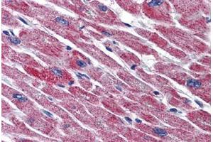 Human Heart: Formalin-Fixed, Paraffin-Embedded (FFPE) (DLD anticorps  (AA 1-510))