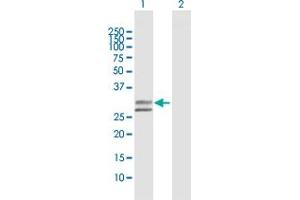 Western Blot analysis of UGCGL2 expression in transfected 293T cell line by UGCGL2 MaxPab polyclonal antibody. (UGCGL2 anticorps  (AA 1-278))