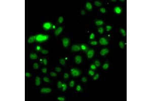 Immunofluorescence analysis of U2OS cells using PMS2 antibody. (PMS2 anticorps)